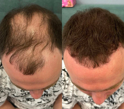 Hair Powder | Capelli Folti e Sani