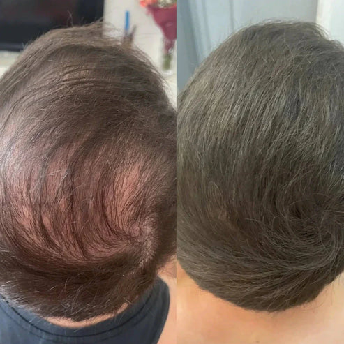 Hair Powder | Capelli Folti e Sani